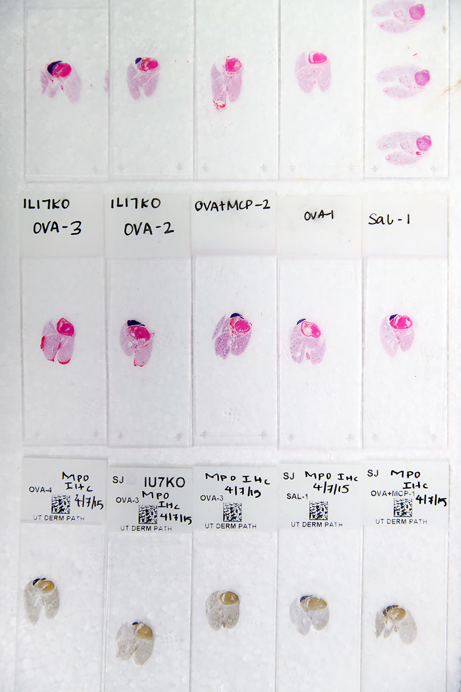 Histology slides to look for airways disease.